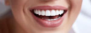Cosmetic Dental Care Can Improve Oral Health Featured Image - Marx Family Dental