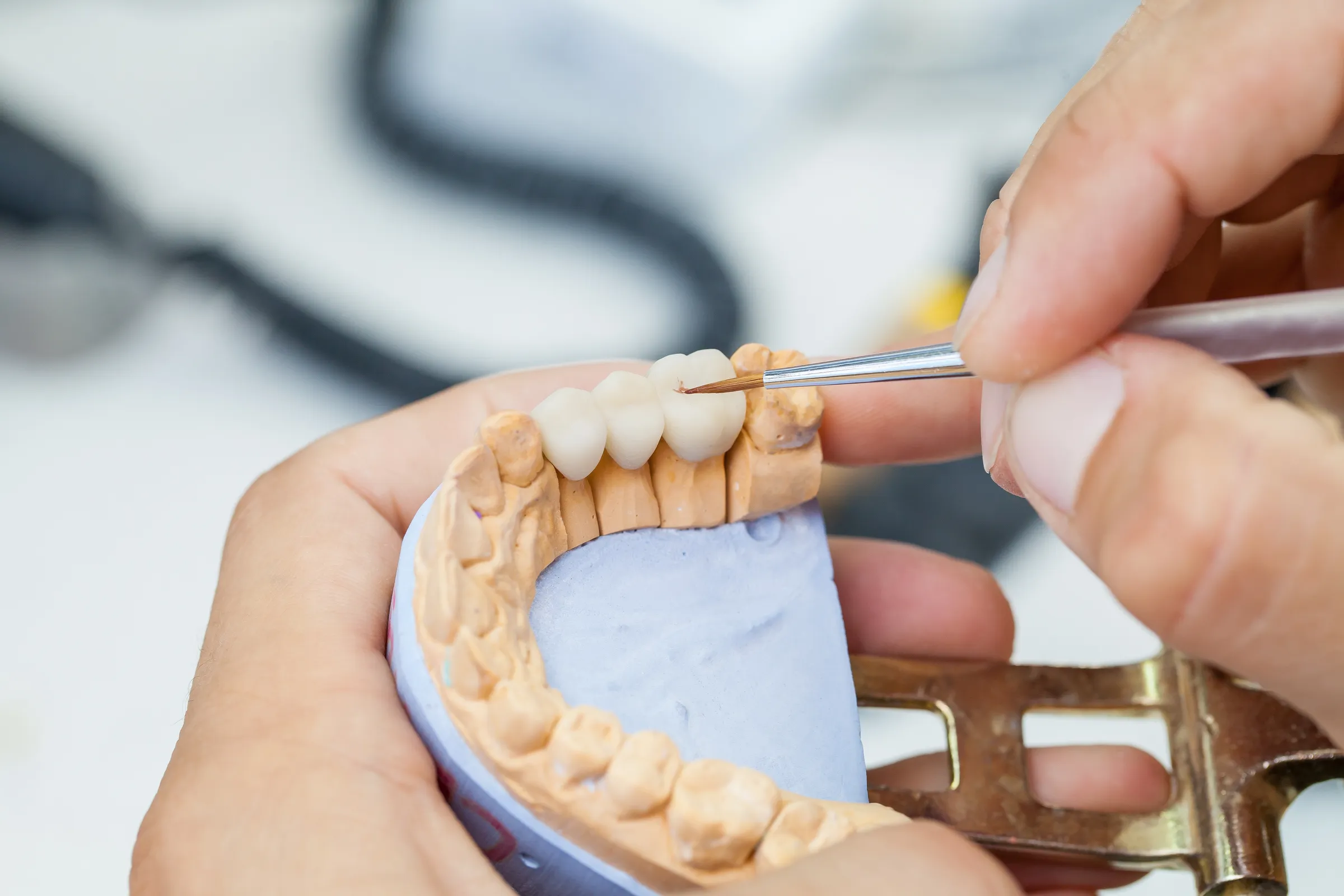 A dental technician shaping a restoration on a model of the teeth