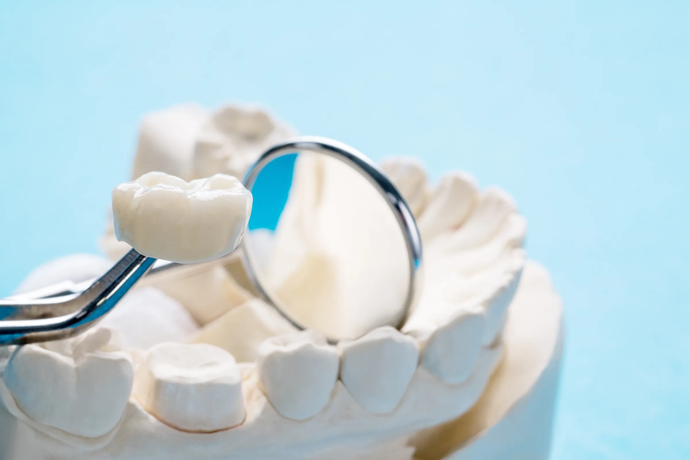 A white ceramic crown beside a dental mirror on a model of the teeth