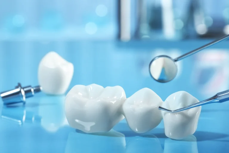 White zirconia crowns and dental instruments on a blue surface
