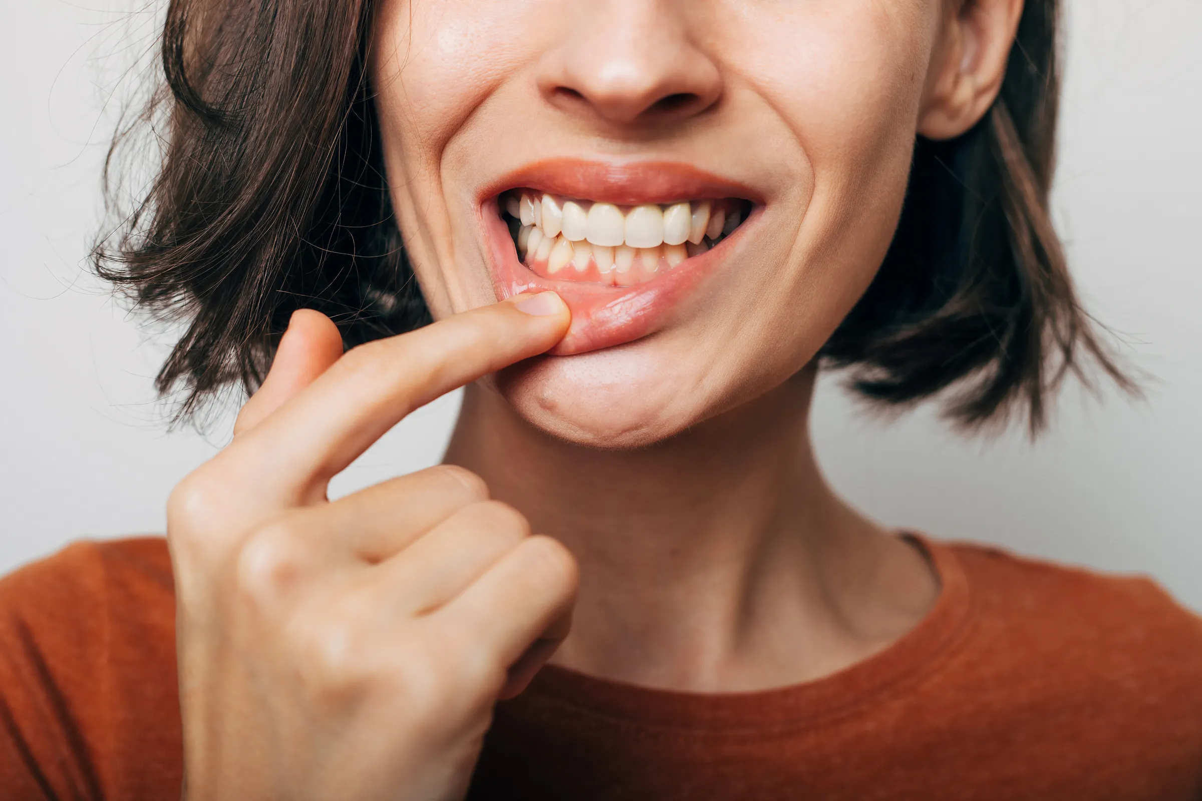 A woman lifting her lip to show her teeth and gums