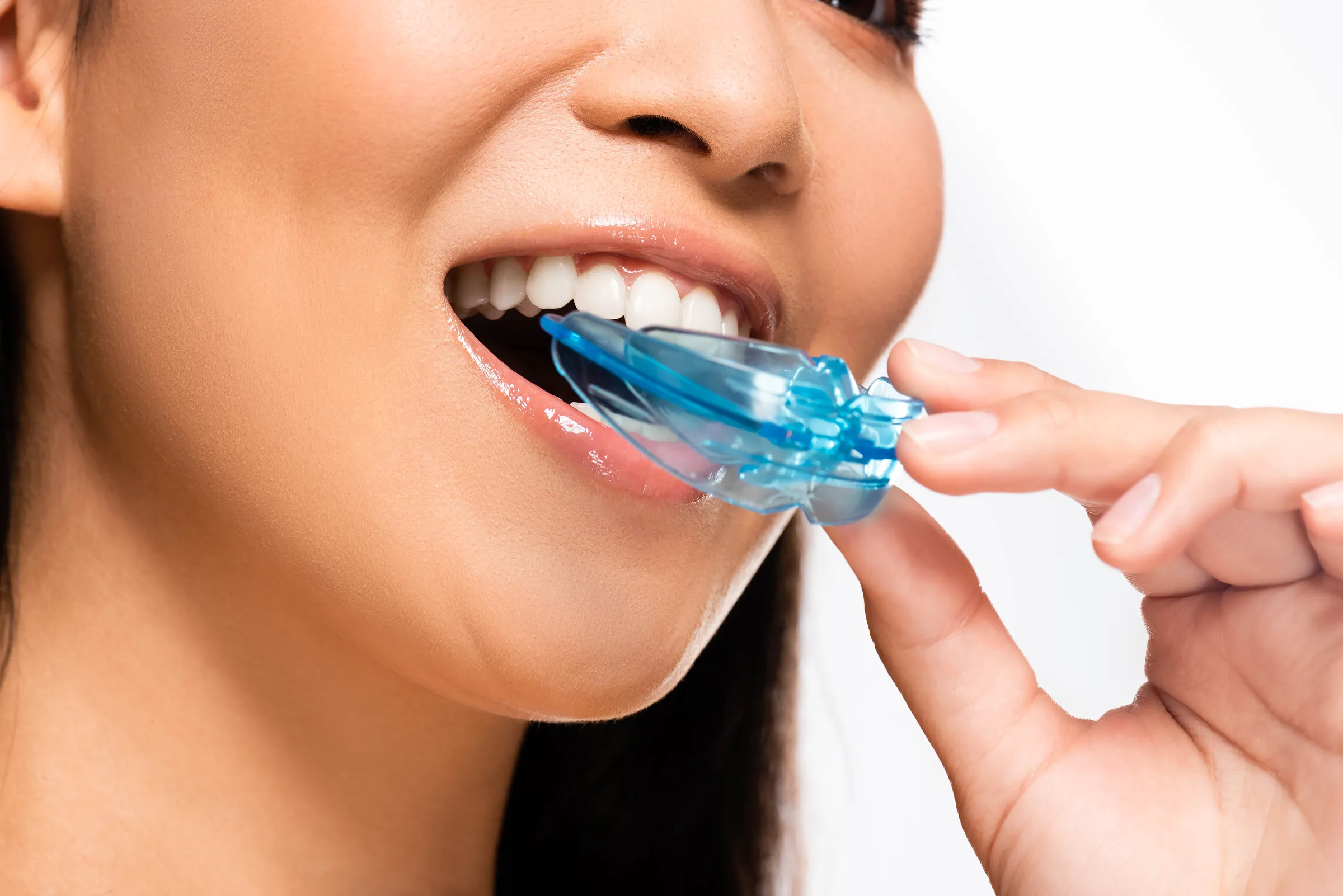 A woman fitting a blue sports mouth guard over her teeth