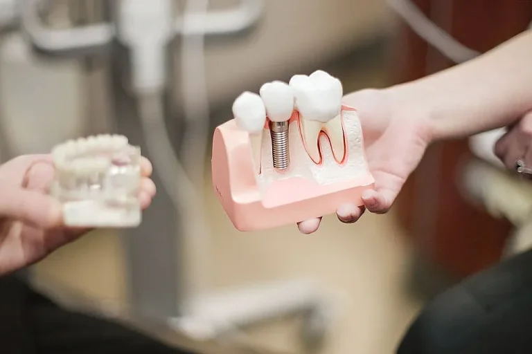 A dental implant model held beside a denture